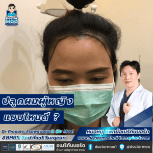 ปลูกผมผู้หญิง แบบไหนดี