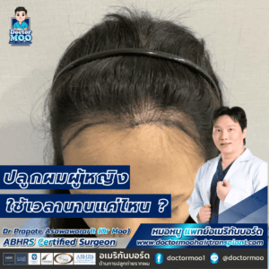 ปลูกผมผู้หญิง ใช้เวลานานแค่ไหน