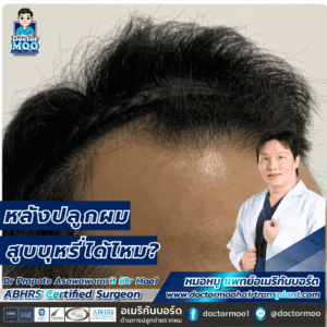 หลังปลูกผมสูบบุหรี่ได้ไหม